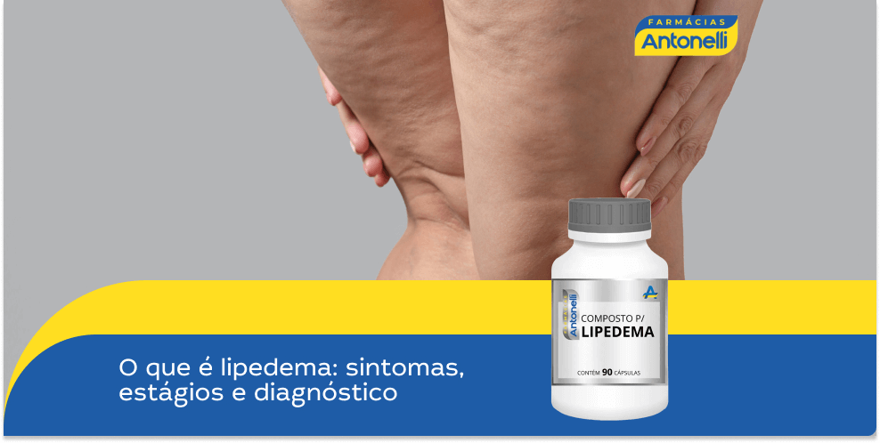 O que é Lipedema: Sintomas, Estágios e Diagnóstico