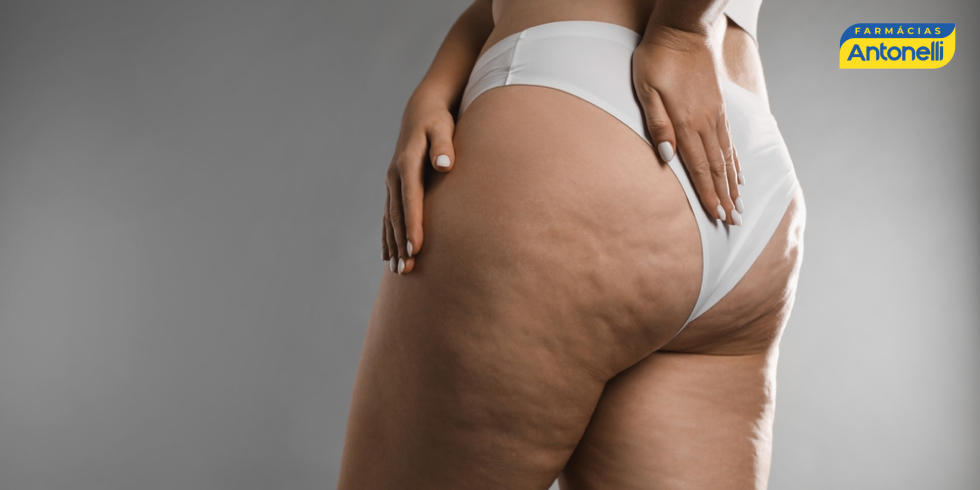 Diferença entre Lipedema, Obesidade e Linfedema